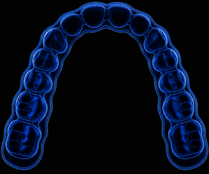 Clear Aligners