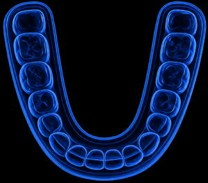 Night Guards / Mouth Guards